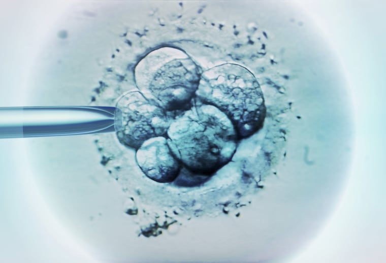 2203331-ivf-embryo-mn-1015-dfc321 Embryo selection for IVF light micrograph