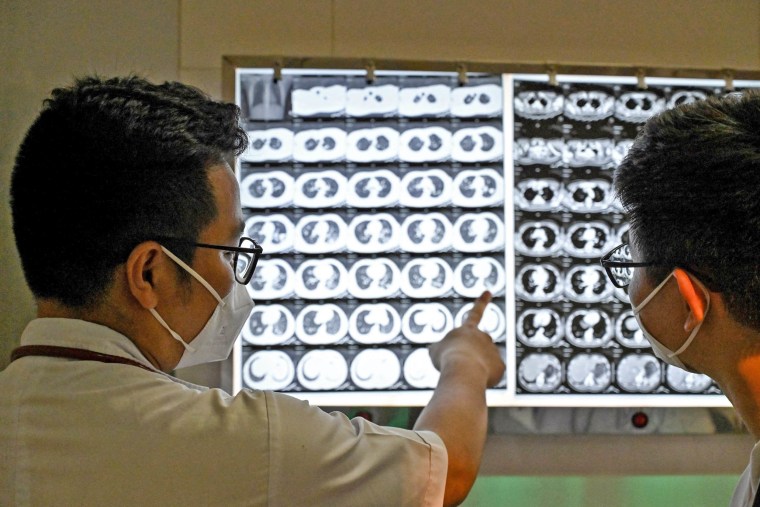 Doctors check X-rays of a drug-resistant tuberculosis patient
