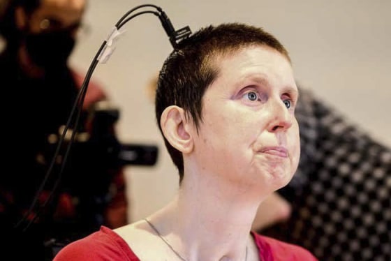 250331-speech-neuroprostheses-1-ew-1122a-bb7214-1 Ann, a participant in a study on speech neuroprostheses