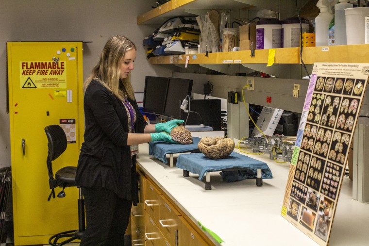250411-harborview-medical-center-2-ew-611p-eaa967 Emily Ragaglia, a director of neuropathology operations, lifts a portion of a recent brain donation from a woman in her 80s at Harborview Medical Center in Seattle.