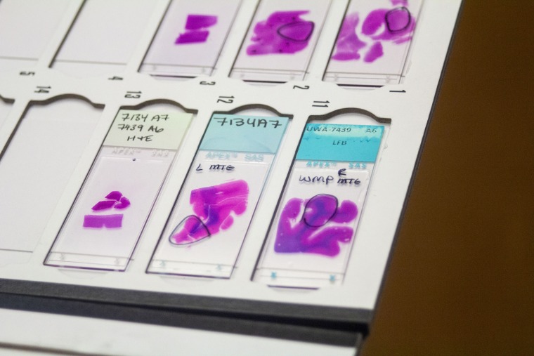 250411-harborview-medical-center-7-ew-611p-784542 Stained slices of brain, which are 5 microns thick, are displayed on slides. The pink stain shows gray matter. The blue stain is white matter.